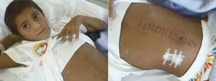 Shakil, ni&ntilde;o jinete pakistani de 8 a&ntilde;os, se recupera de las heridas de una carrera en un hospital de Abu Dhabi (foto de Daoud Hkan)